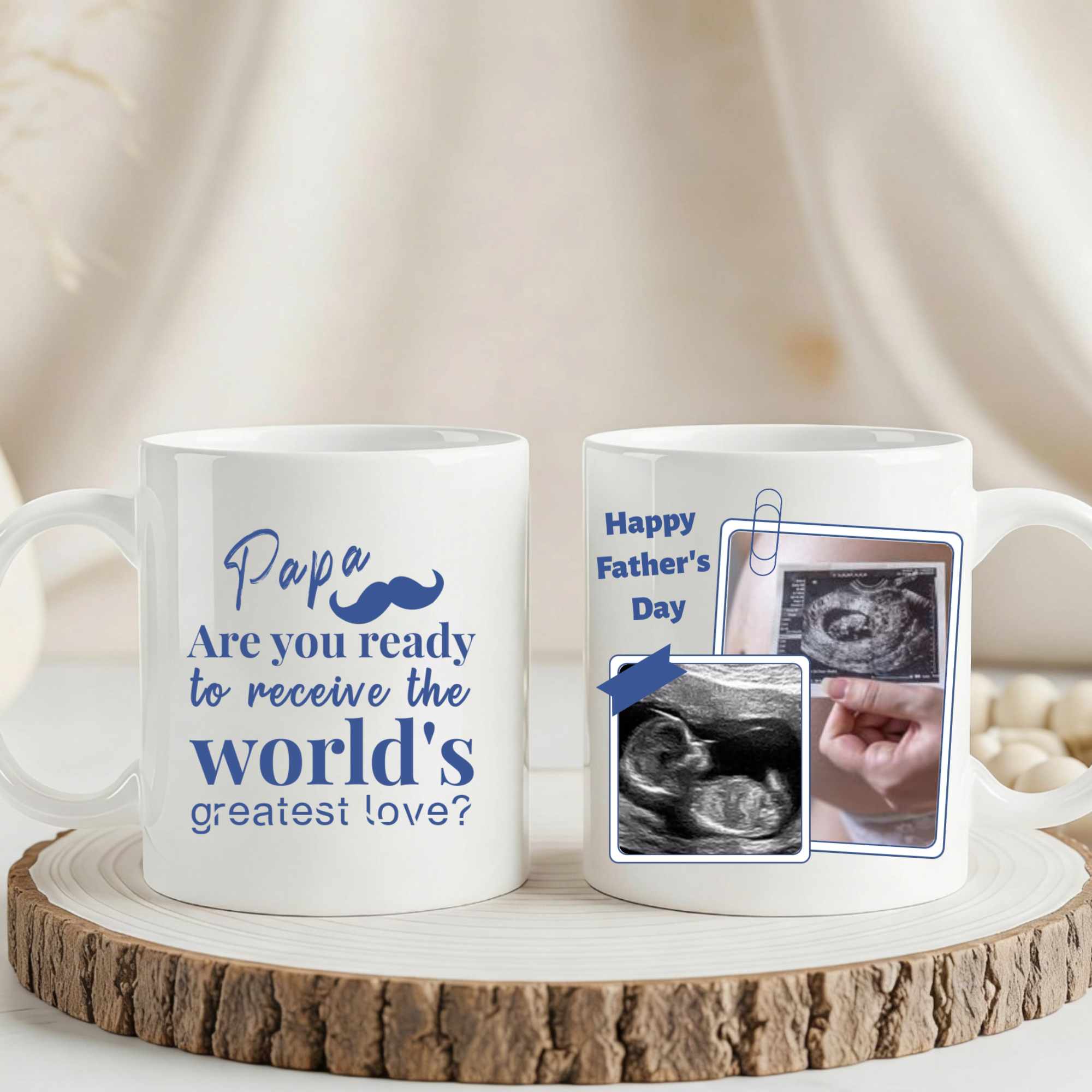 Personalized White Ceramic Mug—"Dad, Are You Ready For This Great Love?" Custom With A Baby Ultrasound Photo, The Perfect Gift For Expectant Father.